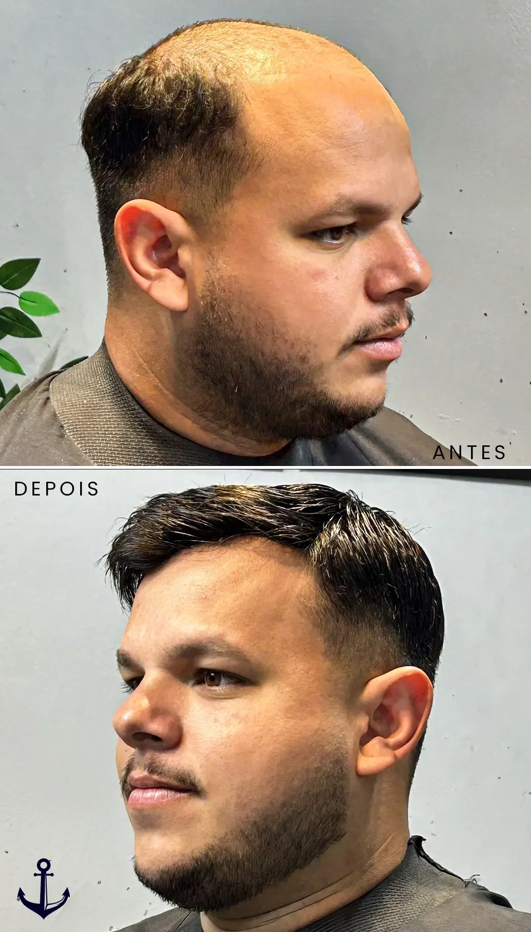 AxD 01 v2