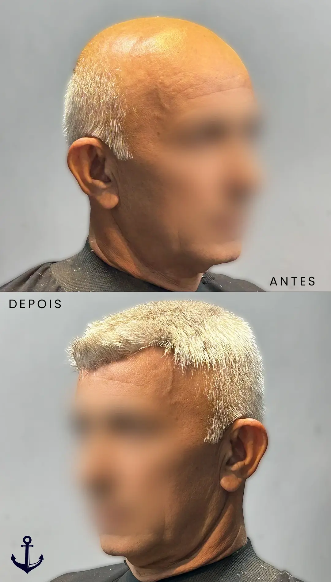 AxD 06 v2